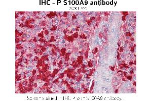 Image no. 1 for anti-S100 Calcium Binding Protein A9 (S100A9) (C-Term) antibody (ABIN1515088) (S100A9 antibody  (C-Term))