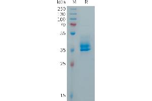 SDS-PAGE (SDS) image for Calcitonin-Related Polypeptide alpha (CALCA) (AA 85-141) protein (Fc Tag) (ABIN6964348)