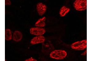 Immunofluorescence staining of methanol-fixed Hela cells using p53(Phospho-Ser15) Antibody. (p53 antibody  (pSer15))