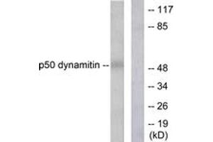 Western Blotting (WB) image for anti-Dynactin 2 (p50) (DCTN2) (AA 341-390) antibody (ABIN2889244) (Dynamitin antibody  (AA 341-390))