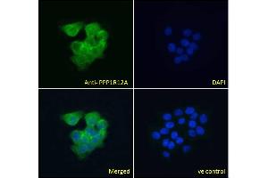 ABIN6391349 Immunofluorescence analysis of paraformaldehyde fixed A431 cells, permeabilized with 0. (PPP1R12A antibody  (C-Term))