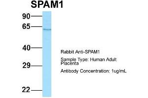 Host: Rabbit Target Name: SPAM1 Sample Type: Human Adult Placenta Antibody Dilution: 1. (SPAM1 antibody  (C-Term))