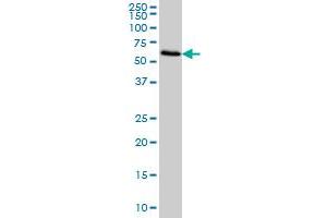 FGL2 monoclonal antibody (M01), clone 6D9 Western Blot analysis of FGL2 expression in HeLa . (FGL2 antibody  (AA 24-123))