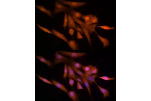Immunofluorescence analysis of NIH/3T3 cells using Ube2L3 / UBCH7 Rabbit mAb (ABIN7271178) at dilution of 1:25 (40x lens). (UBE2L3 antibody)