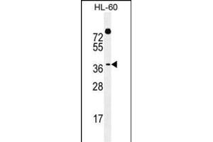 DUX4 Antibody (Center) (ABIN655583 and ABIN2845073) western blot analysis in HL-60 cell line lysates (35 μg/lane).