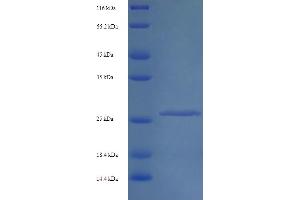 SDS-PAGE (SDS) image for Interferon alpha/beta Receptor 2 (IFNAR2) (AA 22-242) protein (His tag) (ABIN5713534) (IFNAR2 Protein (AA 22-242) (His tag))