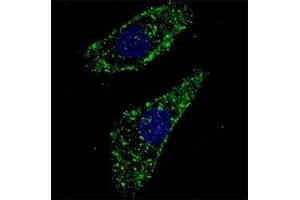 Fluorescent image of U251 cells stained with LAMP1 antibody at 1:200. (LAMP1 antibody  (AA 125-154))