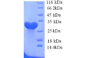 SDS-PAGE (SDS) image for Potassium Inwardly-Rectifying Channel, Subfamily J, Member 1 (KCNJ1) (AA 178-391), (Cytoplasmic Domain), (Cytosolic) protein (His tag) (ABIN5713578) (KCNJ1 Protein (AA 178-391, Cytoplasmic Domain, Cytosolic) (His tag))