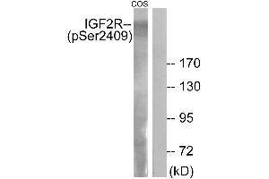 Immunohistochemistry analysis of paraffin-embedded human brain tissue using IGF2R (Phospho-Ser2409) antibody. (IGF2R antibody  (pSer2409))