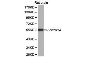 Western Blotting (WB) image for anti-Protein Phosphatase 2 Regulatory Subunit 2A (PPP2R2A) antibody (ABIN1874225) (PPP2R2A antibody)