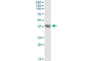 ASPN MaxPab rabbit polyclonal antibody. (Asporin antibody  (AA 1-384))