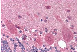 Human Brain, Cerebellum (formalin-fixed, paraffin-embedded) stained with OPTN antibody ABIN214196 at 10 ug/ml followed by biotinylated goat anti-rabbit IgG secondary antibody ABIN481713, alkaline phosphatase-streptavidin and chromogen. (OPTN antibody  (AA 575-591))