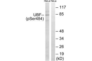 Western blot analysis of extracts from HeLa cells, treated with calyculinA (50ng/ml, 30mins), using UBF (Phospho-Ser484) antibody. (UBTF antibody  (pSer484))