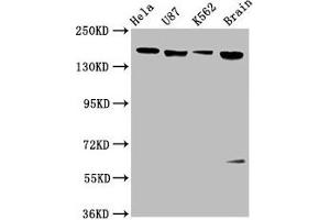 Western Blot Positive WB detected in: Hela whole cell lysate, U87 whole cell lysate, K562 whole cell lysate, Rat brain tissue All lanes: LIFR antibody at 3.