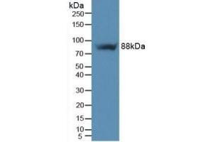 Integrin beta 5 抗体  (AA 137-378)
