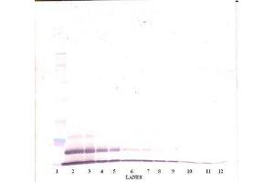 Image no. 3 for anti-Growth Regulated Oncogene gamma (GRO gamma) antibody (ABIN465909) (GRO gamma antibody)