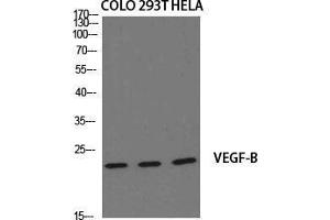 Western Blot (WB) analysis of specific cells using VEGF-B Polyclonal Antibody. (VEGFB antibody  (Internal Region))