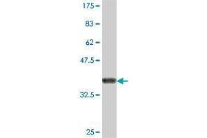 Western Blot detection against Immunogen (35. (COL5A3 antibody  (AA 157-244))