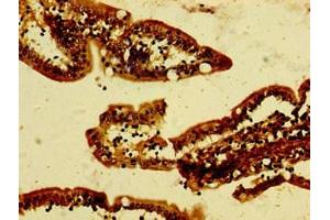 Immunohistochemistry of paraffin-embedded human small intestine tissue using ABIN7144231 at dilution of 1:100 (ANKRD49 antibody  (AA 4-239))