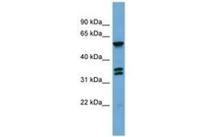 Image no. 1 for anti-G Protein-Coupled Receptor Kinase 4 (GRK4) (AA 359-408) antibody (ABIN6745674)