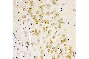 Anti- GRIA2 antibody, IHC(P) IHC(P): Rat Brain Tissue (GRIA2 antibody  (AA 25-360))