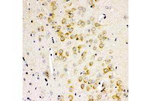 Anti- GRIA2 antibody, IHC(P) IHC(P): Rat Brain Tissue