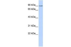 KCTD3 antibody used at 1 ug/ml to detect target protein. (KCTD3 antibody  (Middle Region))