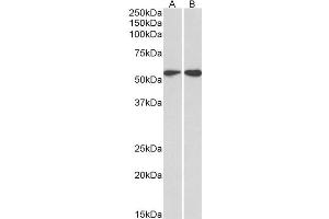 ABIN2613493 (2µg/ml) staining of HeLa (A) and Jurkat (B) lysates (35µg protein in RIPA buffer). (Vimentin antibody  (C-Term))