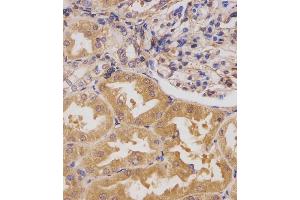 (ABIN391779 and ABIN2841638) staining HIPK3 in human kidney tissue sections by Immunohistochemistry (IHC-P - paraformaldehyde-fixed, paraffin-embedded sections). (HIPK3 antibody  (C-Term))