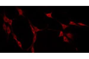 ABIN6275163 staining Hela by IF/ICC. (GIDRP88 antibody  (C-Term))