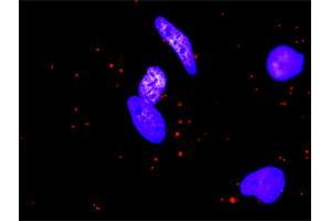 Proximity Ligation Analysis of protein-protein interactions between MMP1 and F2R. (PAR1 antibody  (AA 42-102))