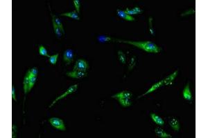 Immunofluorescent analysis of Hela cells using ABIN7144950 at dilution of 1:100 and Alexa Fluor 488-congugated AffiniPure Goat Anti-Rabbit IgG(H+L) (PFKL antibody  (AA 229-479))