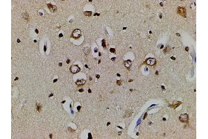Immunohistochemistry (IHC) image for anti-Ephrin B2 (EFNB2) (C-Term) antibody (ABIN6261455)