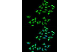 Immunofluorescence analysis of A549 cell using KLK4 antibody. (Kallikrein 4 antibody)