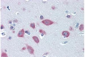 Human Brain, Cortex: Formalin-Fixed, Paraffin-Embedded (FFPE) (FARSB antibody  (AA 234-342))