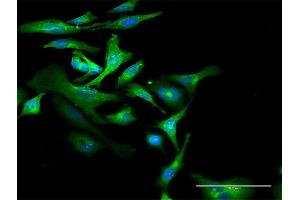 Immunofluorescence of purified MaxPab antibody to CD59 on HeLa cell. (CD59 antibody  (AA 1-128))