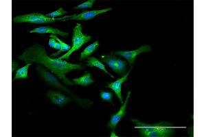 Immunofluorescence of purified MaxPab antibody to CD59 on HeLa cell.