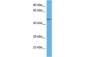 Host:  Rabbit  Target Name:  CYTB  Sample Tissue:  Human OVCAR-3 Whole Cell  Antibody Dilution:  1ug/ml (Cytochrome b antibody  (C-Term))