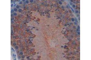 Figure. (Hexokinase 1 antibody  (AA 137-270))