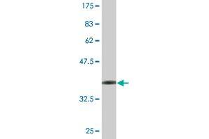 Western Blot detection against Immunogen (36. (FOXP2 antibody  (AA 616-715))