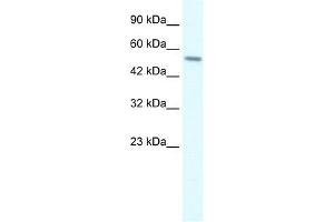 RGS6 antibody used at 2 ug/ml to detect target protein.