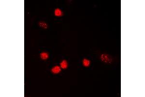 Immunofluorescence (IF) image for anti-Tumor Protein P53 (TP53) (acLys319), (C-Term) antibody (ABIN7301400)