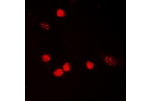 Immunofluorescent analysis of p53 (AcK319) staining in HeLa cells.