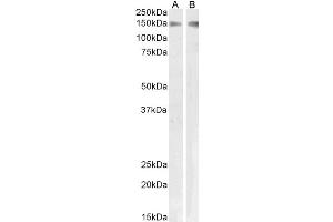 Western Blotting (WB) image for anti-phospholipase A2 Receptor 1, 180kDa (PLA2R1) antibody (ABIN5932307) (PLA2R1 antibody)