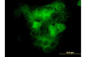 Immunofluorescence (IF) image for anti-Mitogen-Activated Protein Kinase Kinase Kinase 5 (MAP3K5) (AA 1231-1374) antibody (ABIN517859)