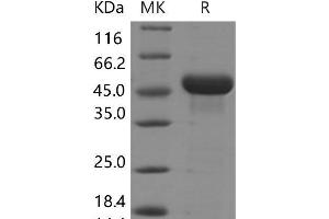 Western Blotting (WB) image for Reticulocalbin 3, EF-Hand Calcium Binding Domain (RCN3) protein (His tag) (ABIN7320014) (RCN3 Protein (His tag))