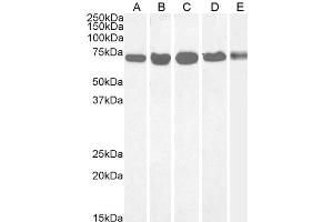 DDX5 antibody  (C-Term)