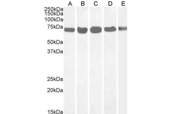 DDX5 antibody  (C-Term)