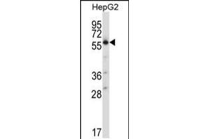 Western blot analysis in HepG2 cell line lysates (35ug/lane). (SLC30A1 antibody  (C-Term))