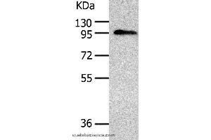 Western blot analysis of Human liver cancer tissue, using AKAP8 Polyclonal Antibody at dilution of 1:500